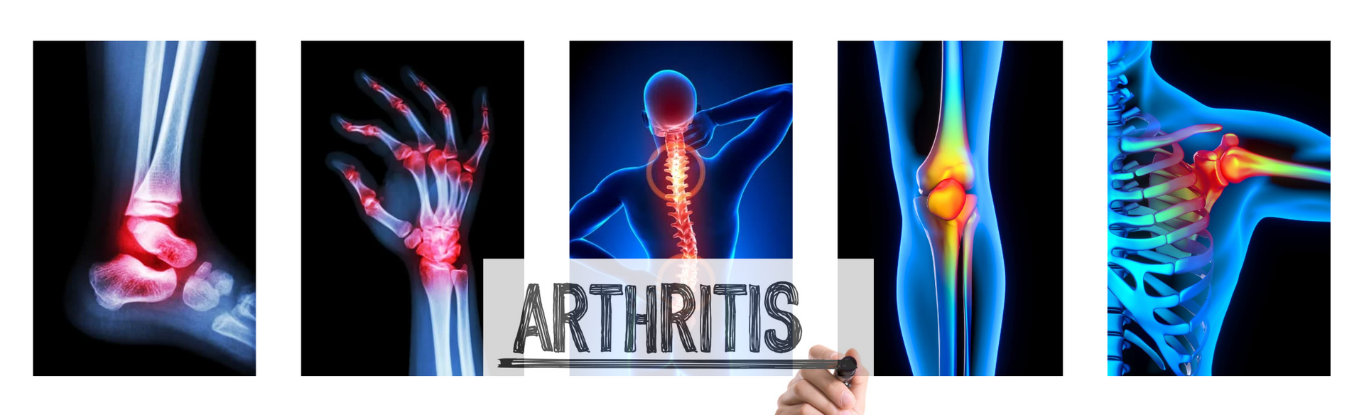 Why More People Are Turning to CBD for Everyday Joint Support